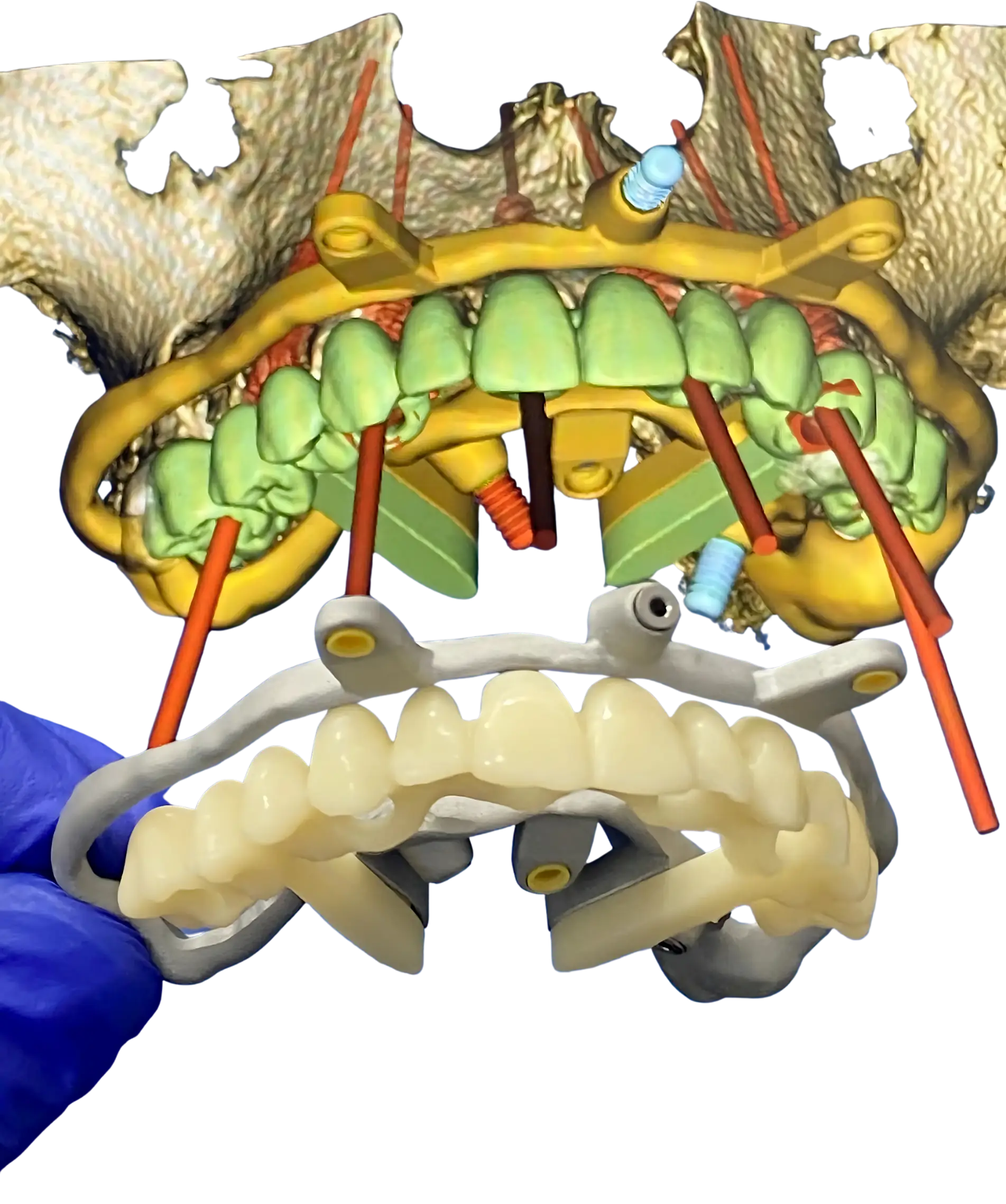 foto formaciones cero fallo dental_