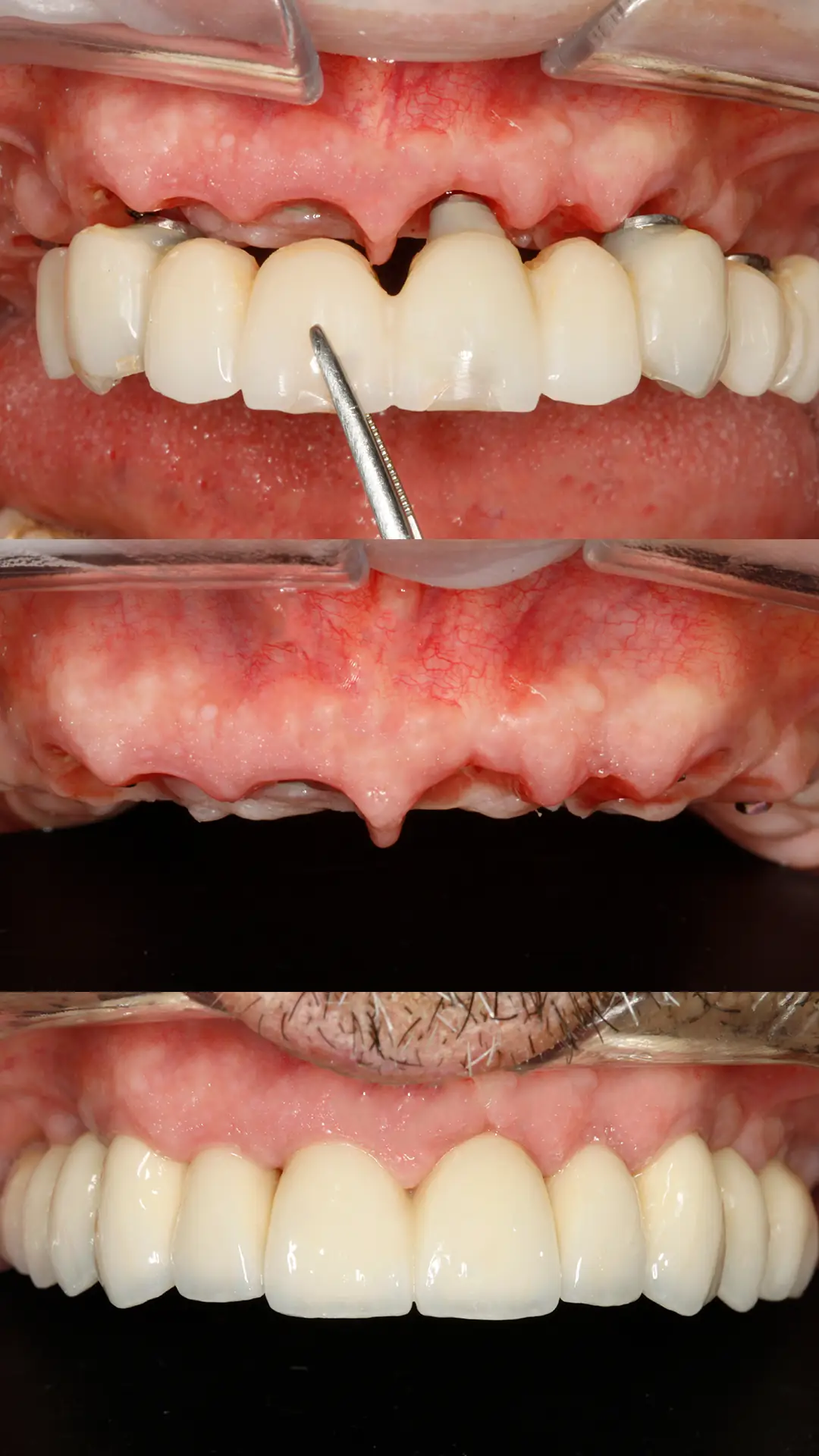 composicion-fomacion-Cirugia-guiada-v2 Formación: Cirugía guiada